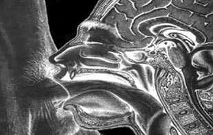 «Вафлизм» в подростковом возрасте - Автор Неизвестен